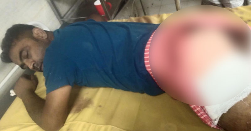 আহত মোসারফ হোসেন সাবু