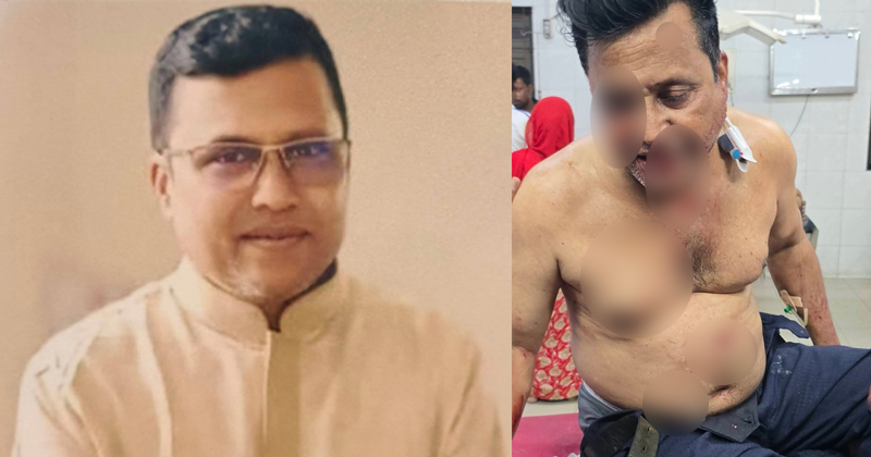 গুলিবিদ্ধ শফিকুল ইসলাম আজম