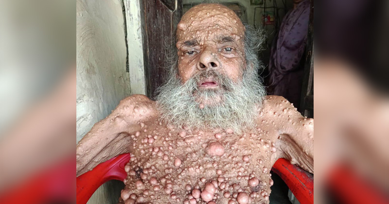 দুরারোগ্য রোগে আক্রান্ত বিএনপির একনিষ্ঠ কর্মী মজিবর রহমান