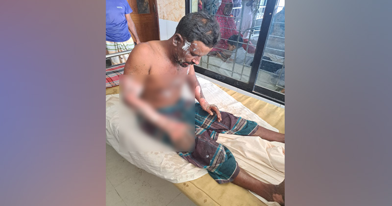 নওগাঁয় মাদক মামলার সাক্ষীর গায়ে পেট্রল ঢেলে আগুন